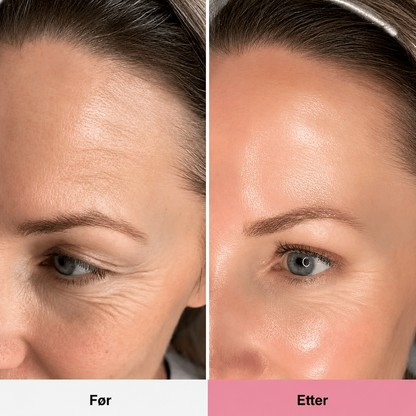 PDRN Pure Collagen Balm